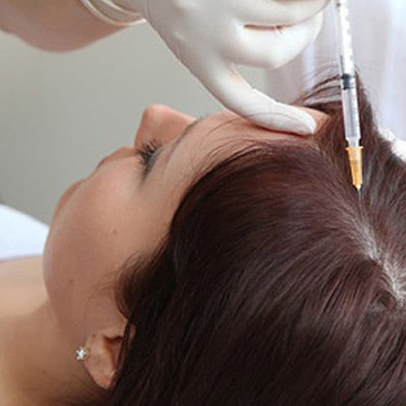Micro-rouleau pour cheveux, favorise la santé des cheveux, soins pour la  repousse, microniddle, mésothérapie, traitements